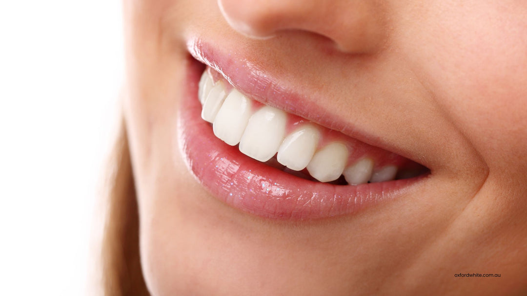 What Are Teeth Whitening Strips and How Do They Work?