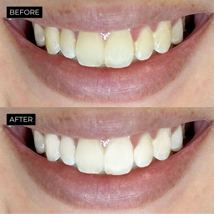 Advanced teeth whitening strips and Flourishing Finish serum for a dazzling smile